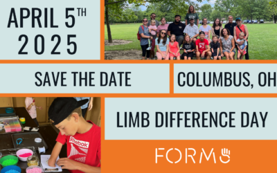 Limb Difference Day